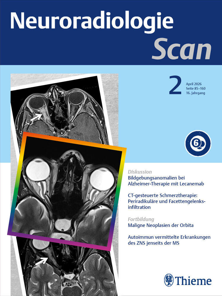Journal cover of "Neuroradiologie Scan"